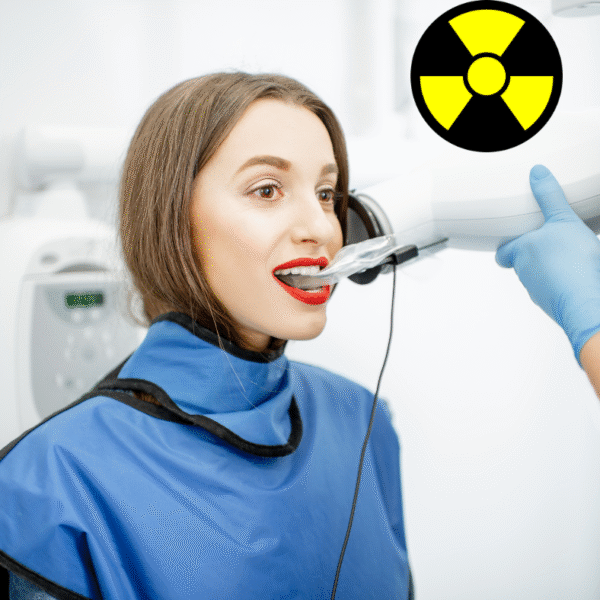 projekt osłon radiologicznych dla aparatu punktowego w stomatologii