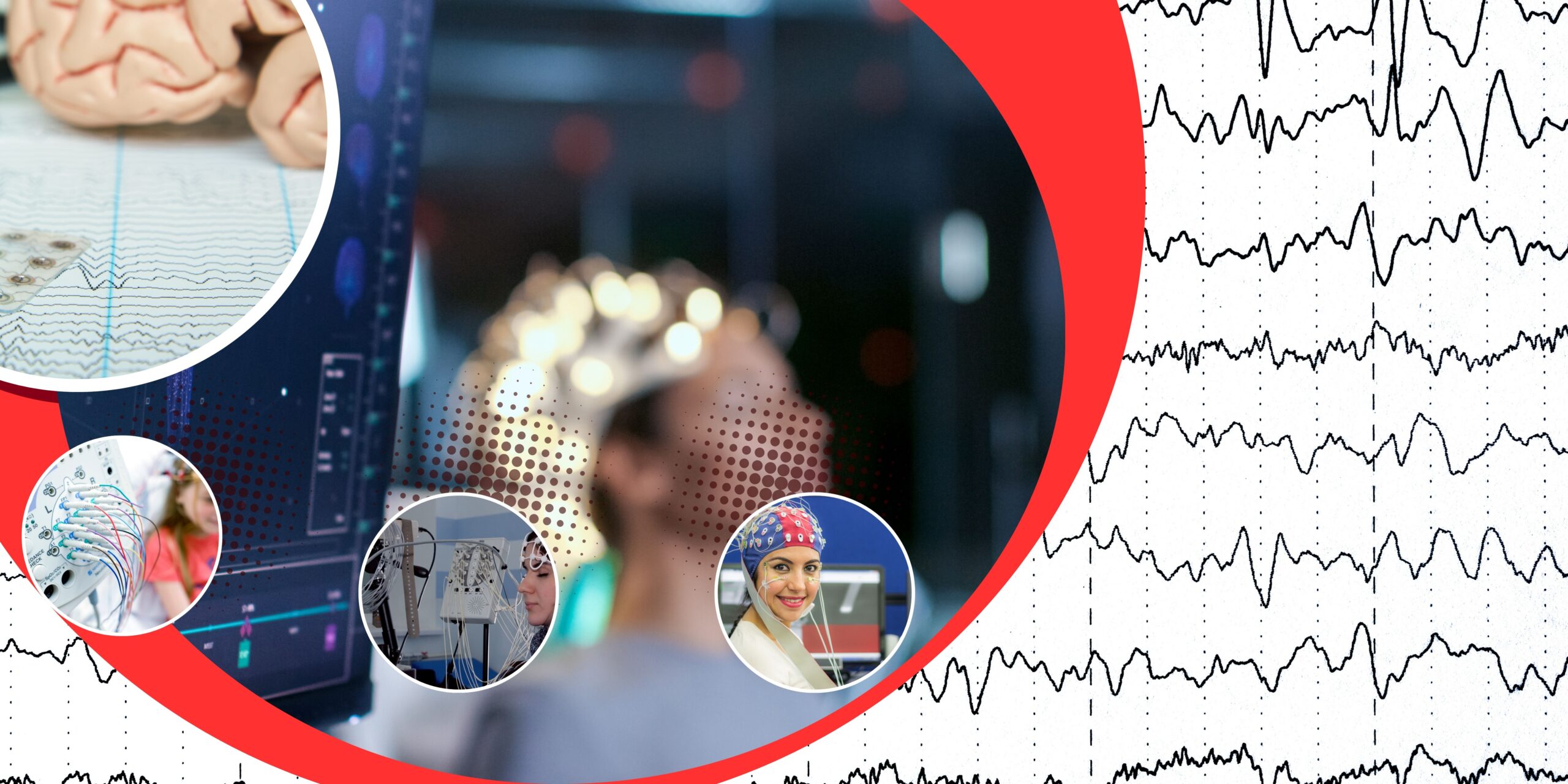 EEG w praktyce : Diagnostyka, Klinika i Nowoczesne Technologie