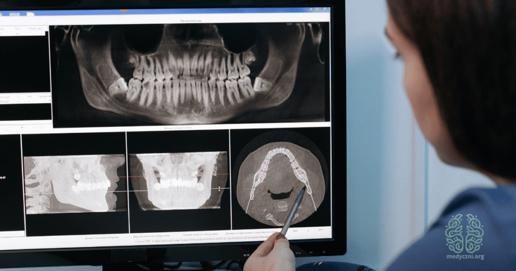 Radiologia stomatologiczna: Najczęstsze błędy, które popełniają dentyści