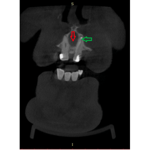 CBCT 2