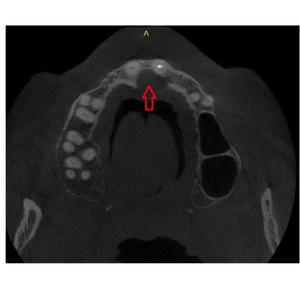 CBCT