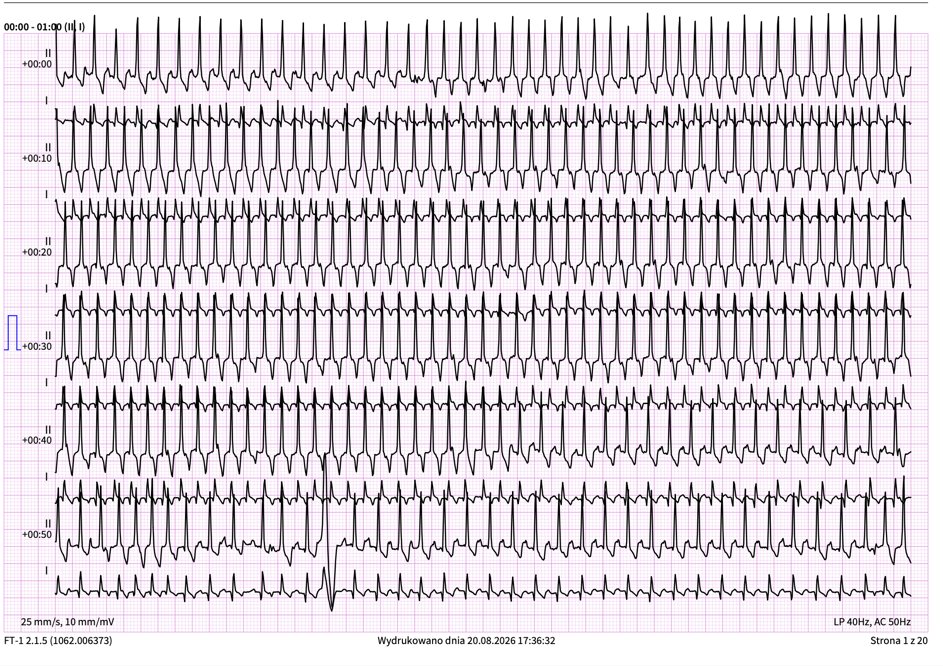 ekg u zwierzęcia